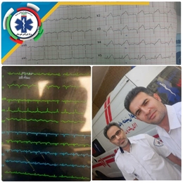 تشخیص سریع سکته قلبی؛ نجات جان پزشک در شیبان